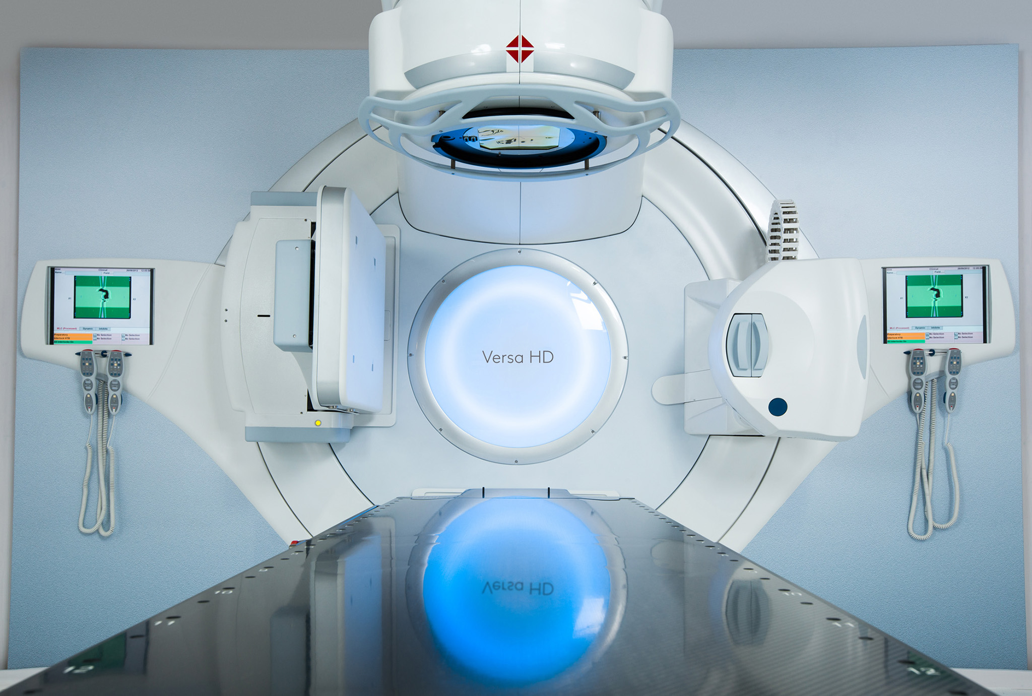 SRS (Stereotactic Radiosurgery)